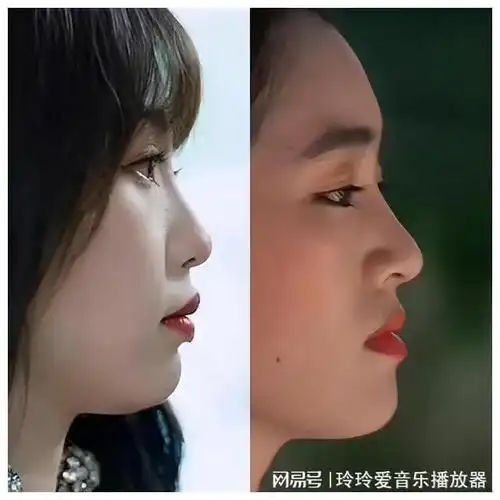 凸嘴短下巴塌鼻梁面中凹陷这些女明星的侧脸也太真实了