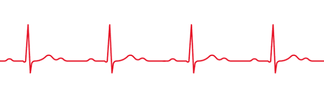 心跳稍慢的人更长寿!这里有一份护心方等你查收···_按摩