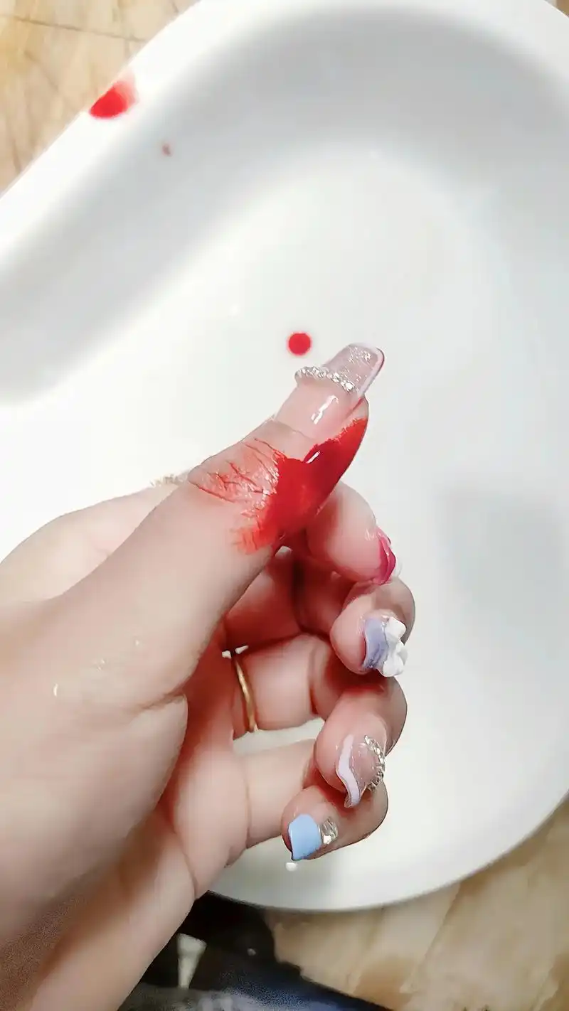 生活是什么,生活就是切菜切到手,自己淡定的 喷点药,拿创口贴 - 抖音