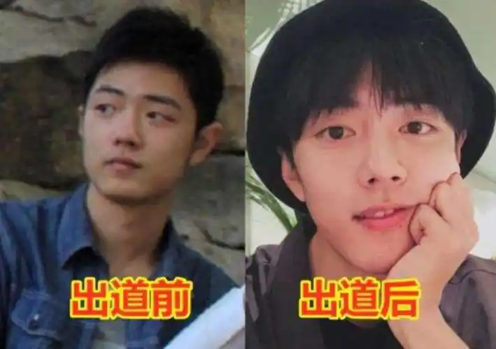 出道前后颜值的反差,其实肖战之前是因为太胖了,如今瘦下来的他,不仅
