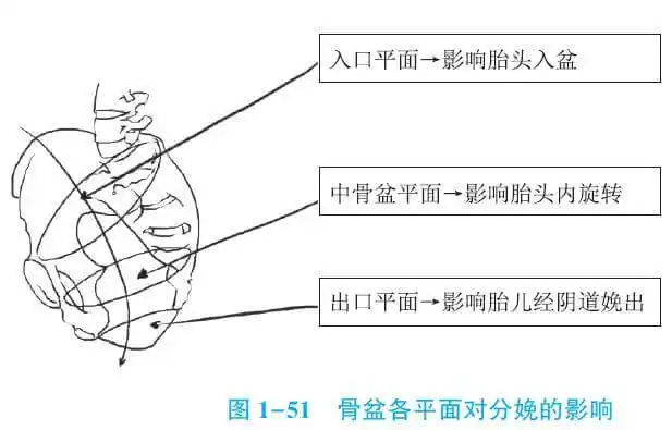 临床助理医师考试妇儿精华考点产道异常