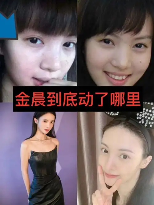 金晨的鼻子是整个面部最亮眼抓人,也是变化最多的部位.