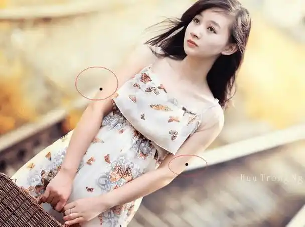 痣生在左手臂的外侧,距肩膀有5个指头的位置,典型的进财痣.