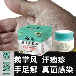 手癣膏真菌感染鹅掌风手足癣藓汗疱疹湿疹止痒去根治干裂脱皮药膏