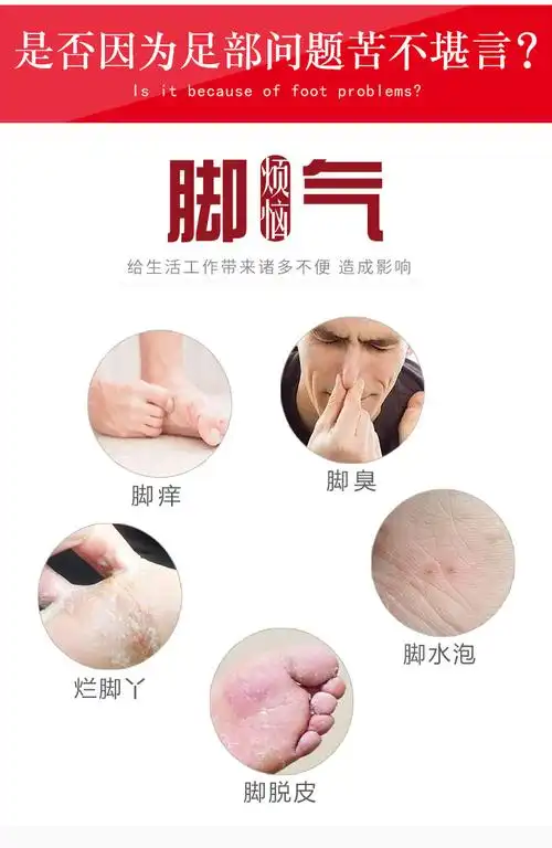 脚气克星汤大夫治脚气脚臭中药2袋券后298元包邮