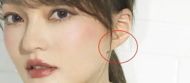 实际上,这些情况也会导致耳垂有折痕!