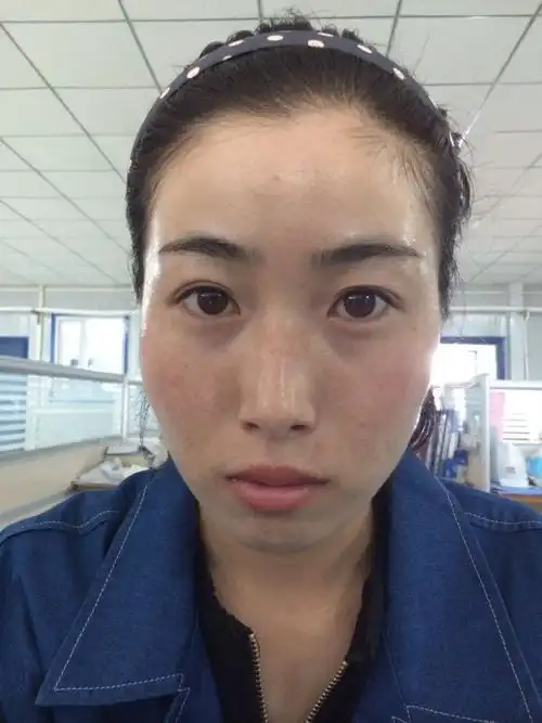 我的皮肤不好吗