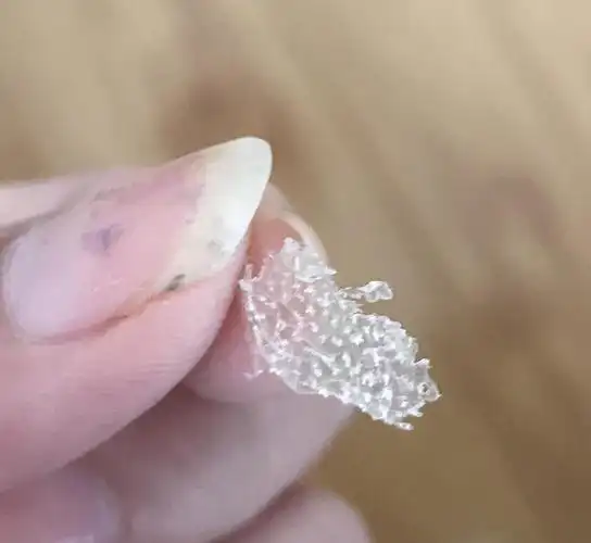 慎入我大概抠出了世界上最大的头皮屑