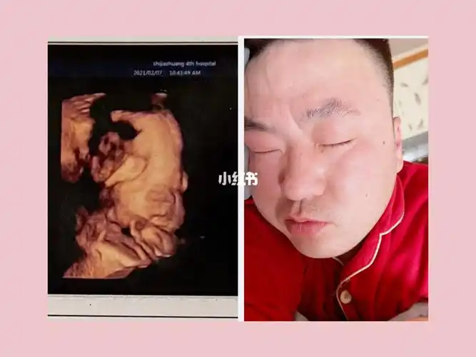 宝宝和他爹的鼻子一样