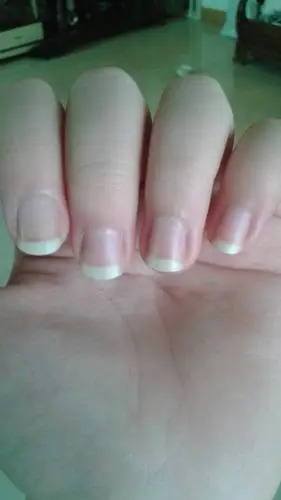 为什么我的指甲会那么白