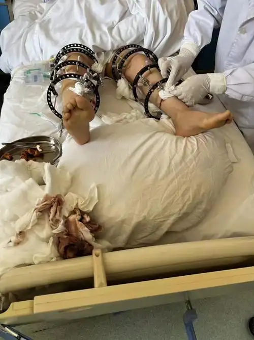 扶贫济困残肢先行弘化社重建新生助残活动与爱共行