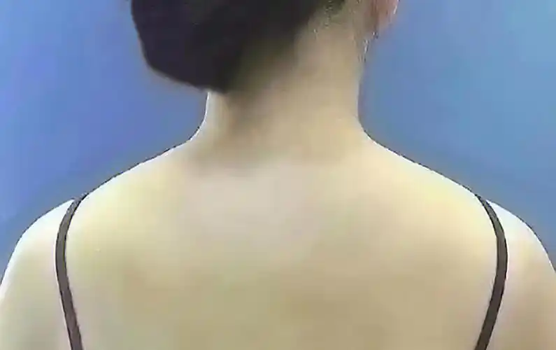 这位小姐姐也有着厚厚的斜方肌,明明是可爱娴静的女子背面看却让人