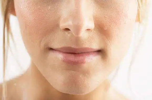 怎样改善皮肤粗糙 脸部皮肤粗糙小妙招
