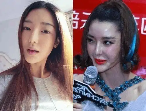 明星整容失败的后遗症到底有多恐怖网友还好我没整