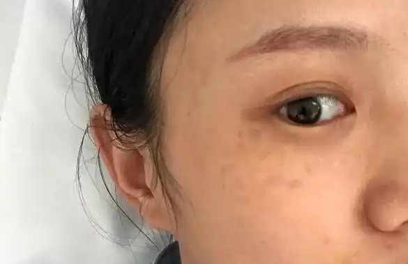 这些问题在中医上看来其实是由于气滞血瘀所致,为什么这么说呢?