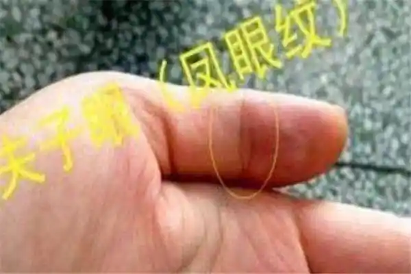 凤眼纹不封闭穷一辈子可能导致生活窘迫生活不好