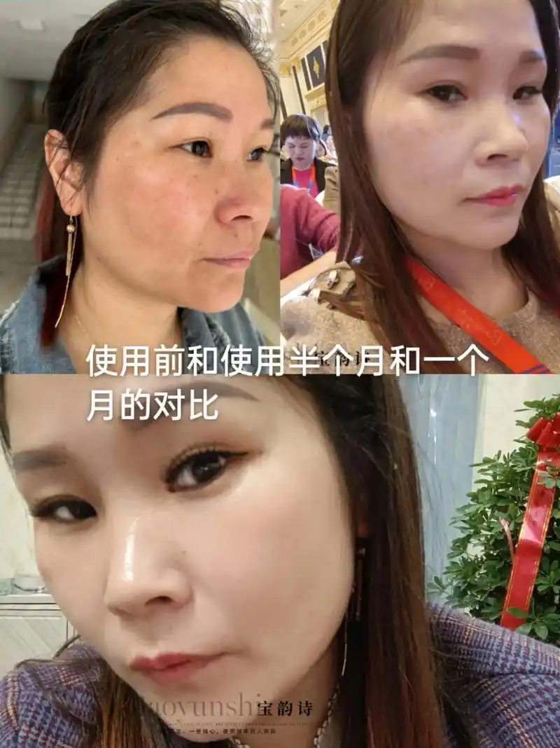 这是我使用前后的对比 .#用一次就爱上的护肤品 #打造素颜灯 - 抖音