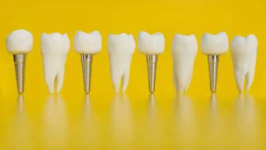 人类种植牙. 人类牙齿或假牙在黄色背景3d渲染上照片