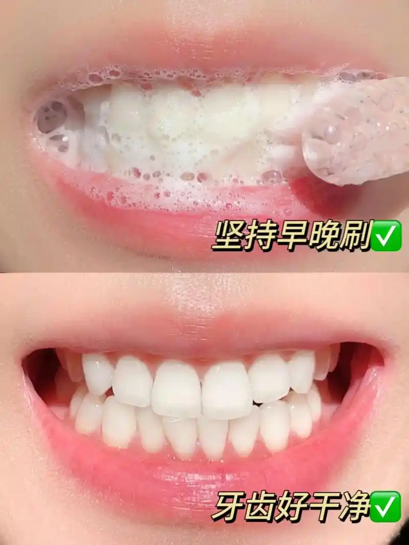 牙齿就像女人,男人的第二 - 抖音