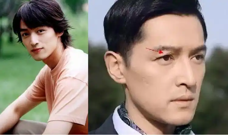 因意外而惨遭毁容的明星,胡歌车祸,俞灏明烧伤,而她被狗咬伤