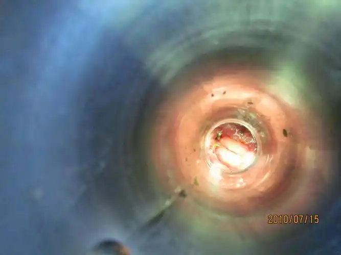 混合痔手术3年钛钉怎么没有未脱