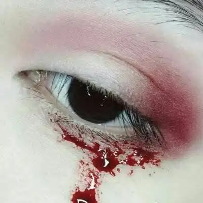 眼睛流血图片(眼底出血图片啥样)