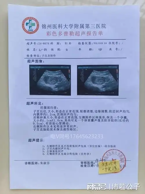 这几类的女性要注意了可能怀孕的血检有点大