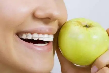 牙齿美白整形资讯