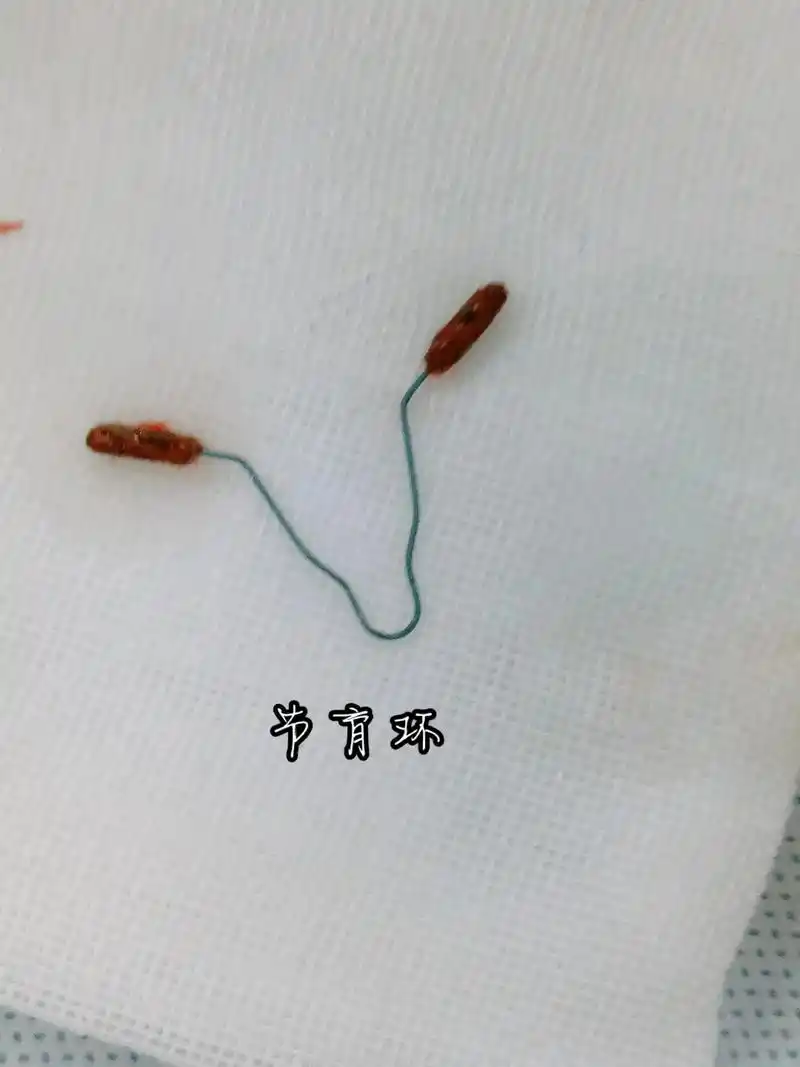 绝经后节育环要及时取出!——高平市人民医院妇科# - 抖音