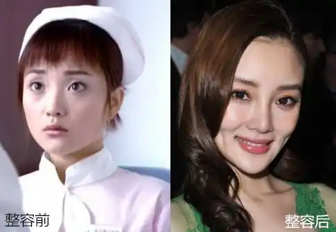 (李小璐整容前后对比照)当然了,如果你想改变大脸这个现状,也并不是没