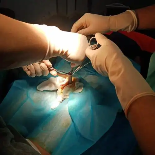 包皮吻合器(包皮环切缝合器)包皮环切术的优缺点