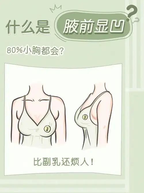 不成形71如果有请对镜自查,94腋下副乳和乳房交界处是否有凹陷?