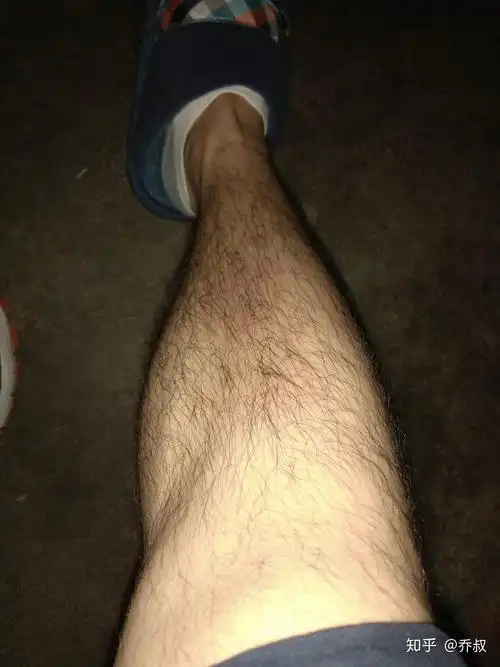 腿毛多是怎样一种体验