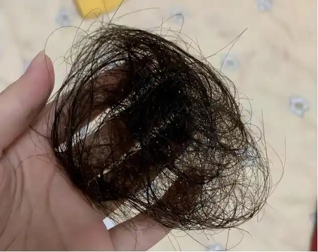 头发一直掉,靠吃东西能补回来吗?