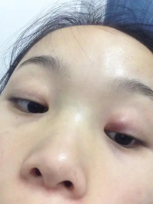 各位宝妈帮忙看看 谢谢