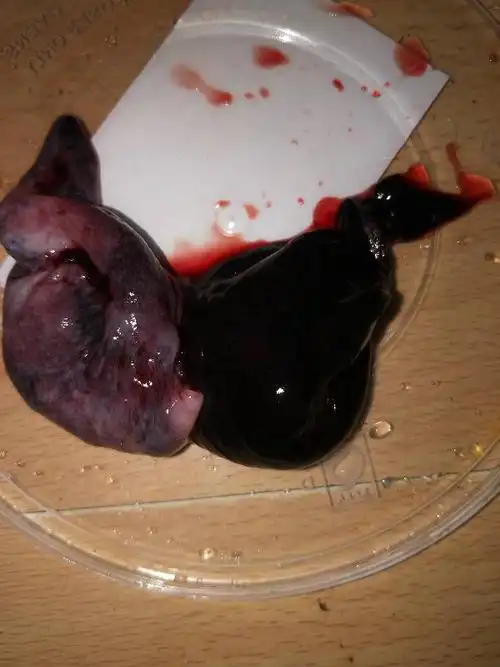 我怀孕两个月了,我就想知道这个东西是孕囊吗?