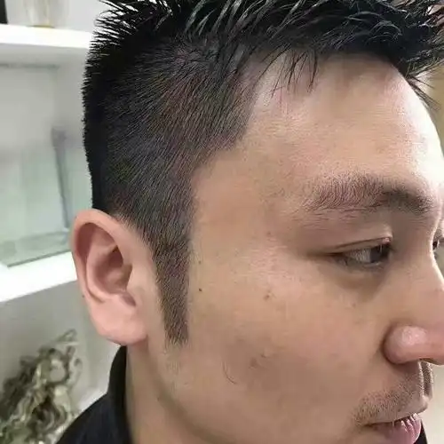 大家看看种植鬓角后看起更加有男人味