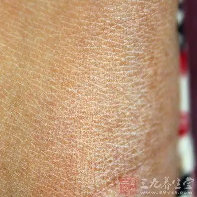 女性皮肤干燥粗糙是什么原因皮肤干燥起皮屑怎么办