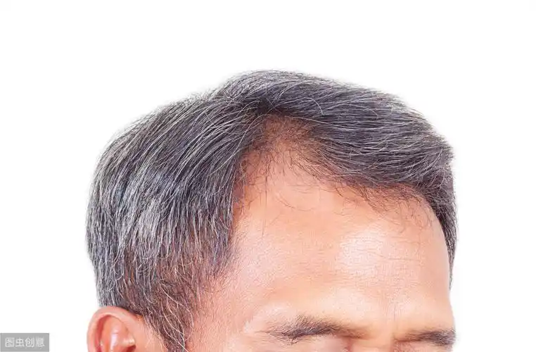 如何改善白头发教你5招击退白发