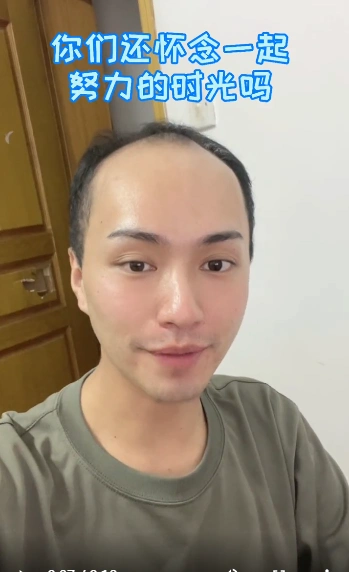 网红楚淇晒高中素颜照,皮肤黝黑穿着土气发际线高一点也不帅,如今完成