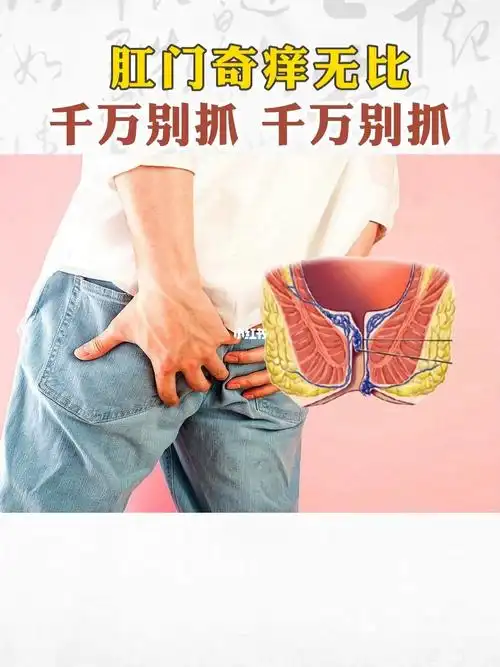 肛周湿疹   #肛门瘙痒   #肛肠科   #肛肠疾病