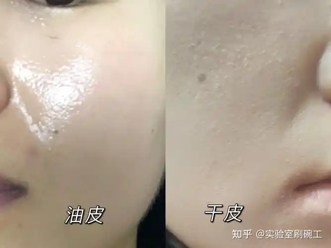 总听到干性皮肤,油性皮肤,如何样判断自己属于哪一种肤质?