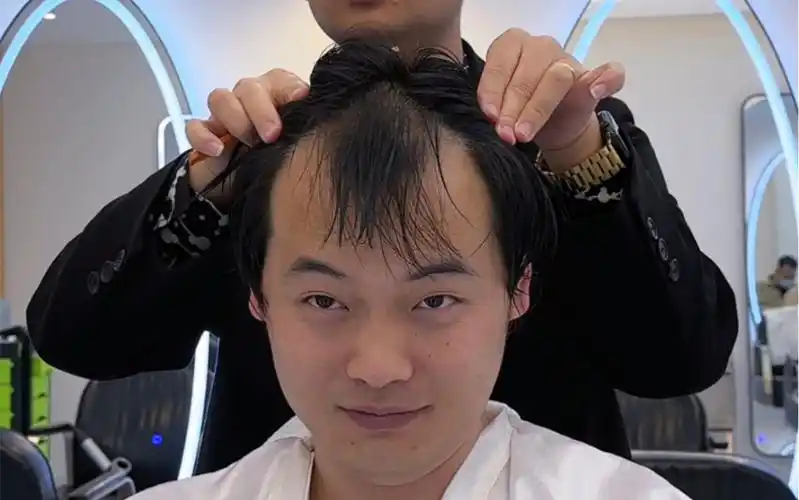 高m型发际线就适合这样的发型