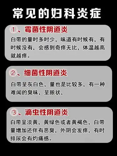 妇科炎症有哪些症状 盘点妇科炎症的常见症状