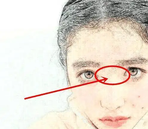 山根折断的女人