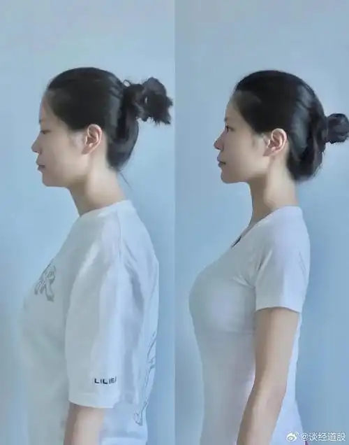 你是不是发现自己的脖子会不自觉地前倾,还含胸驼背?