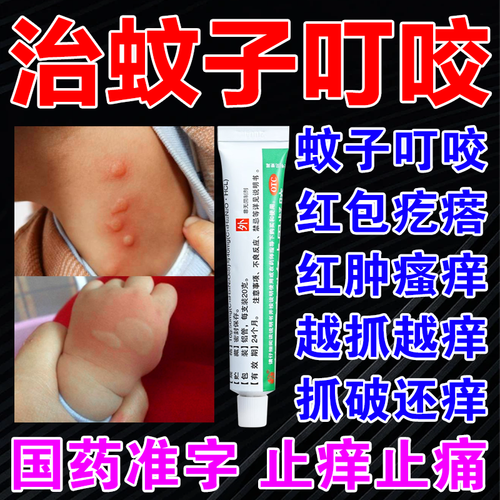 绿药膏治蚊虫叮咬止痒消肿药膏儿童成人蚊子咬涂的药膏蚊子包止痒消肿