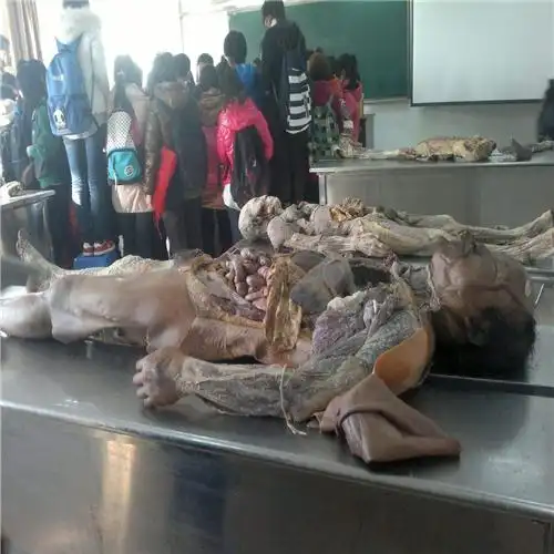 心脏瓣膜性疾病