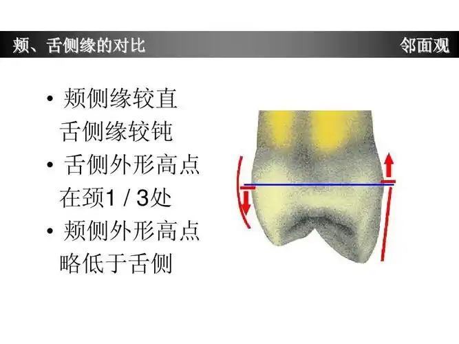 上颌第一前磨牙牙体形态简述ppt