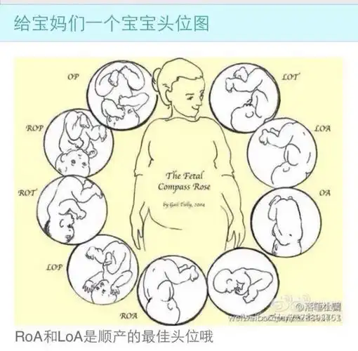 孕检头位是什么意思